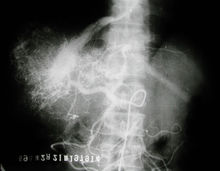 肝脏影像图
