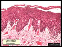 食管黏膜