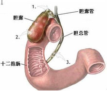 【苗岭舒胃方】治疗胃溃疡