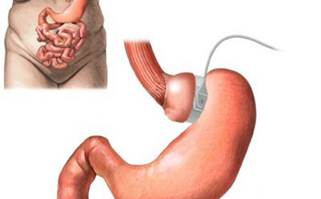 常见的胃癌症状表现有哪些