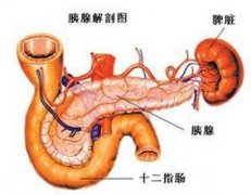 慢性胰腺炎治疗方法