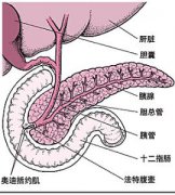 胰岛素瘤治疗方法