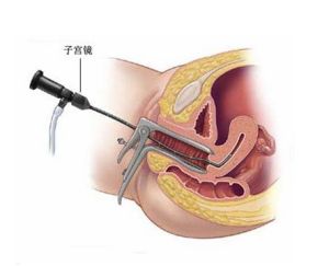 特色诊疗技术—腹腔镜　宫腔镜